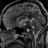 Taking Care of your Pain